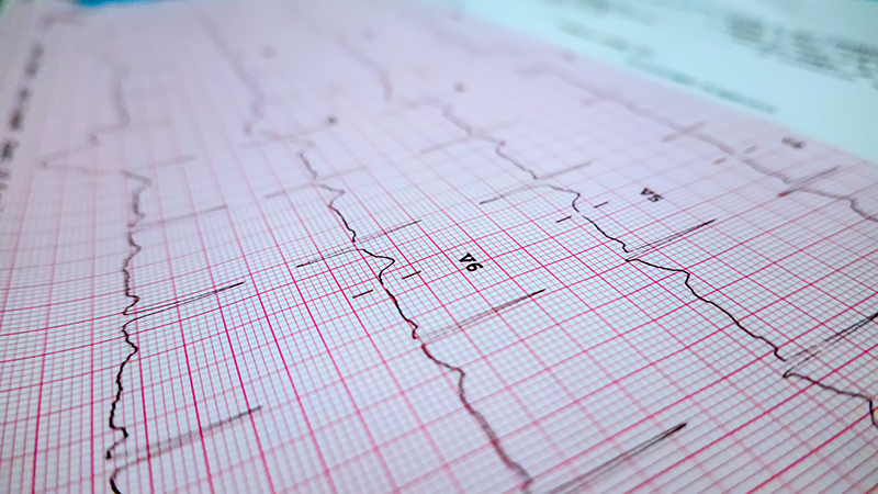 Pacemaker Medical Cards By The Card Project UK