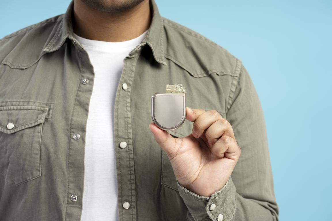 Man holding a pacemaker device over the left side of his chest, illustrating the typical size and placement of a cardiac implant
