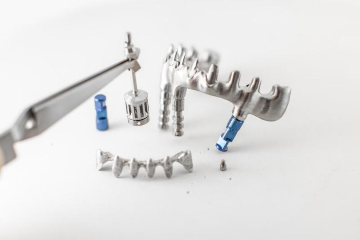  Close-up of the precision-engineered metal components of a custom dental implant bridge on a white background.