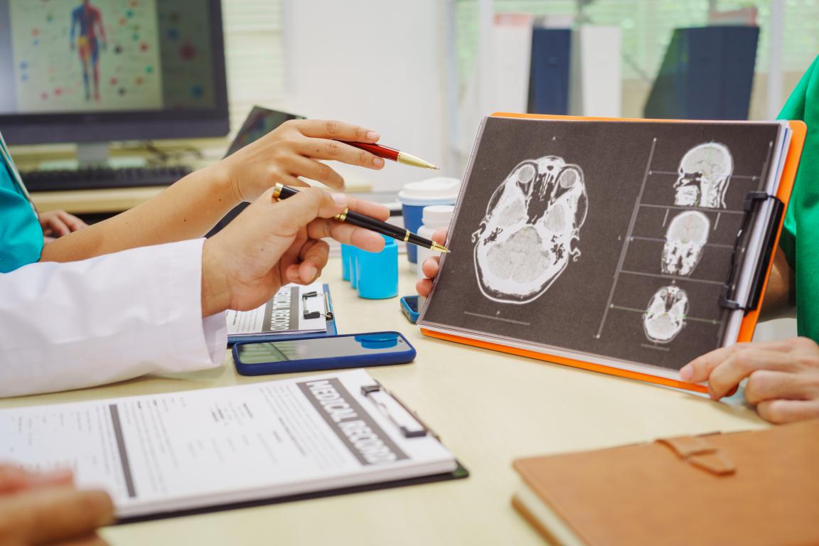  A group of medical professionals discussing medical records and looking at a brain scan displayed on a tablet.