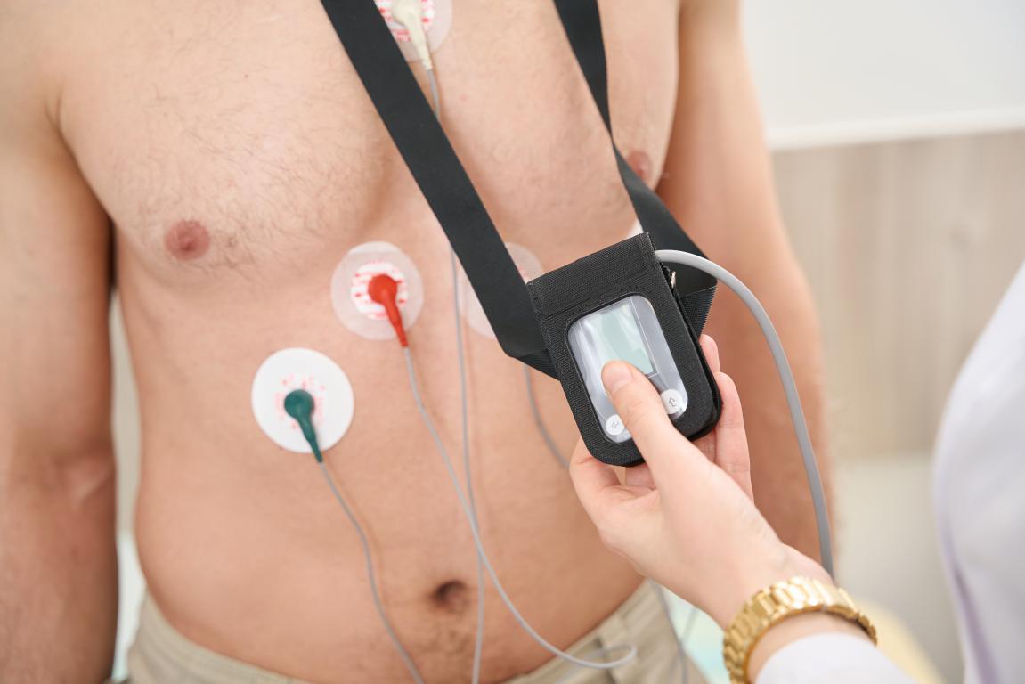 A healthcare professional adjusting a Holter monitor with electrodes attached to a male patient's chest, performing an ECG recording to assess heart rhythms potentially relevant to ICD needs