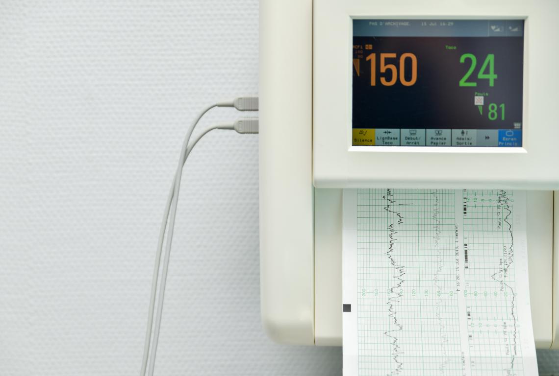 A medical monitor displaying complex ECG waveforms and vital signs, representing the kind of heart rhythm data an ICD continuously monitors. 