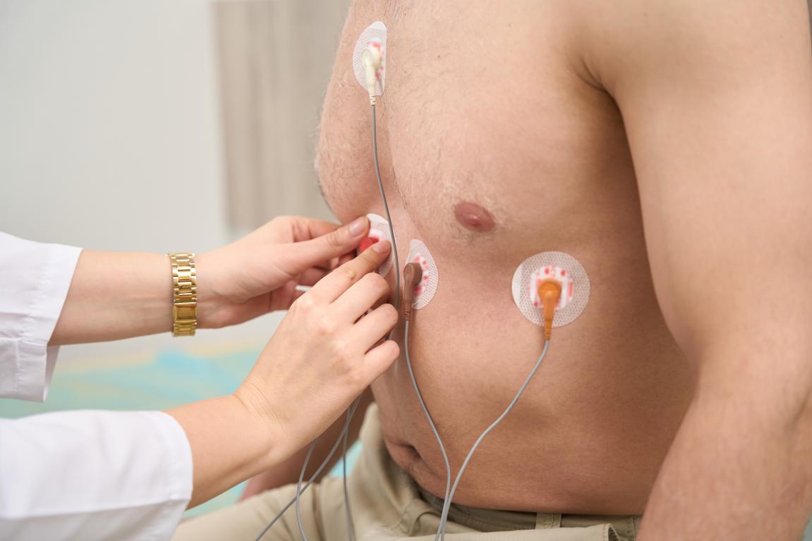 A healthcare professional gently places ECG electrodes on a patient's chest, preparing for heart monitoring, a common part of managing an ICD.