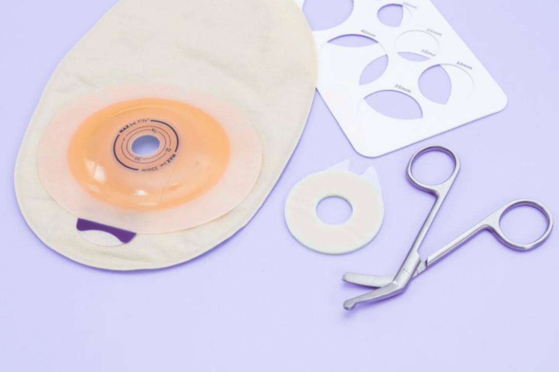 A flat lay of colostomy bag supplies including a new bag, a stoma measuring guide, an adhesive wafer, and a pair of small medical scissors on a light purple background